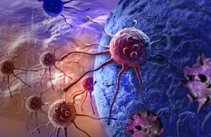 Cellules cancereuses