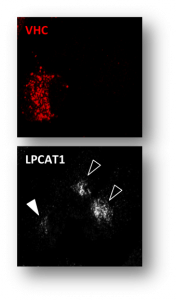 vhc_lpcat1